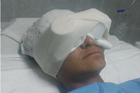 El Congreso de Chihuahua pidió al Gobierno Estatal atención médica integral y reparación del daño para un joven del CECYTECH que perdió la vista en un accidente escolar.