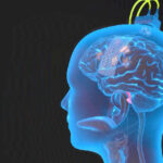 Descubre cómo un revolucionario implante cerebral está devolviendo la capacidad de hablar a personas que la perdieron por derrame cerebral.
