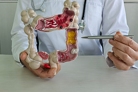 El IMSS en Chihuahua alertó sobre los peligros de la úlcera péptica y pidió atención médica ante síntomas como dolor abdominal, acidez y vómitos. No tratarla puede llevar a hemorragias o cáncer.