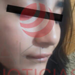 Una alumna del Cetis agredió a su compañera con un boxer, causándole una descalabrada y lesión mandibular; la madre denuncia falta de acción.