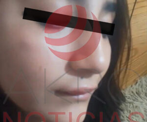 Una alumna del Cetis agredió a su compañera con un boxer, causándole una descalabrada y lesión mandibular; la madre denuncia falta de acción.